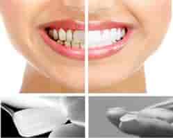 Подтвержденные отзывы пациентов о Dentart Implant and Aesthetic Dentistry в Istanbul, Turkey Slider image 1