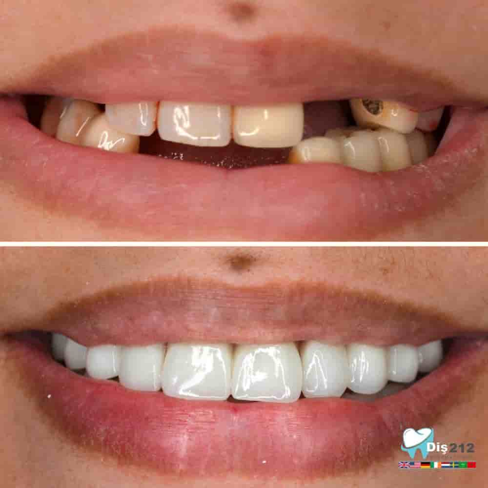 Подтвержденные отзывы пациентов о Dis 212 - Dental Aesthetics Facility в Istanbul, Turkey Slider image 2