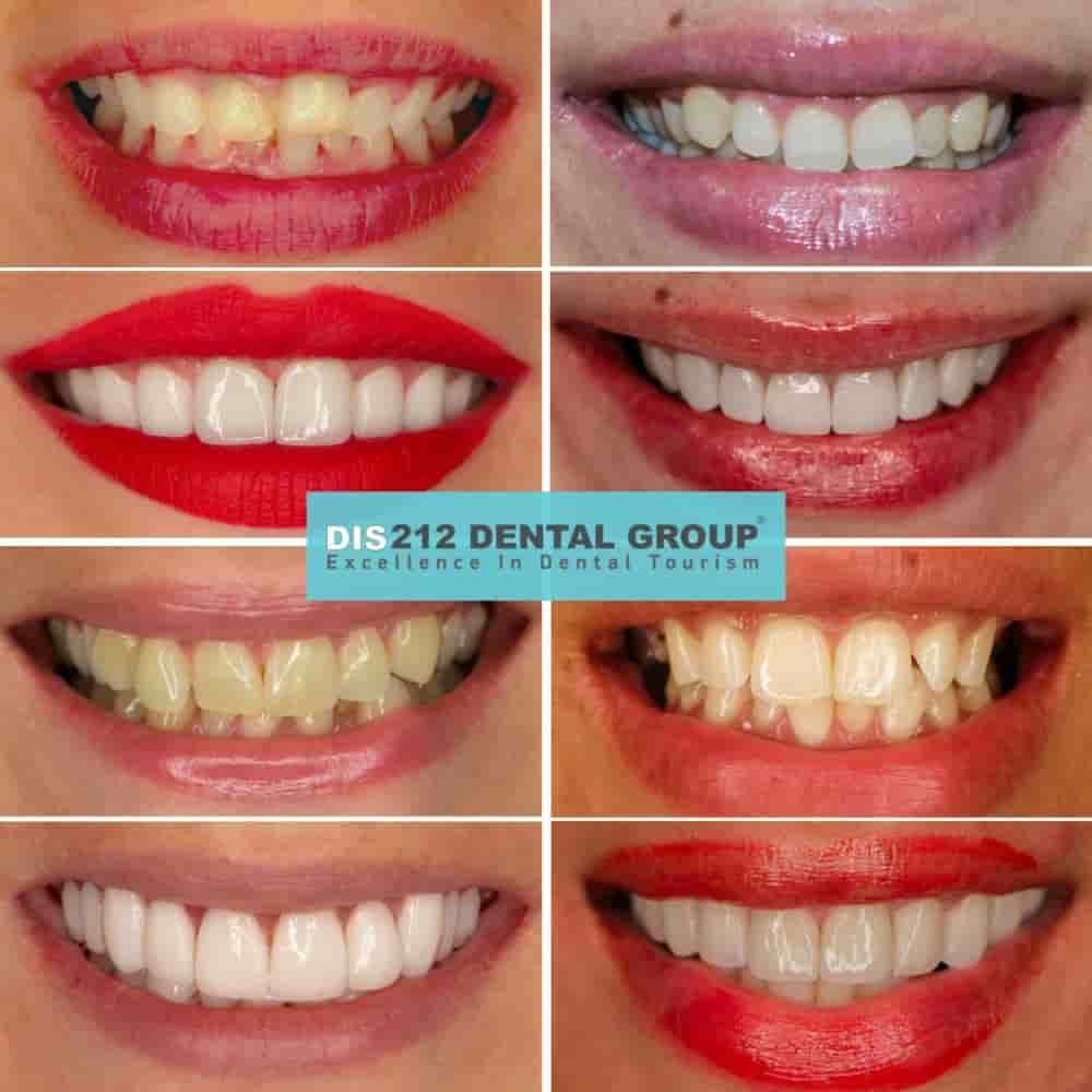 Подтвержденные отзывы пациентов о Dis 212 - Dental Aesthetics Facility в Istanbul, Turkey Slider image 3