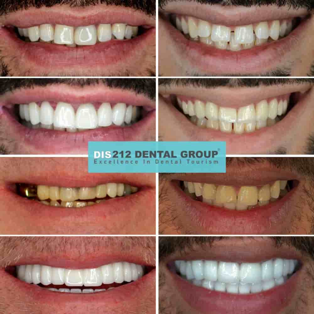 Подтвержденные отзывы пациентов о Dis 212 - Dental Aesthetics Facility в Istanbul, Turkey Slider image 4
