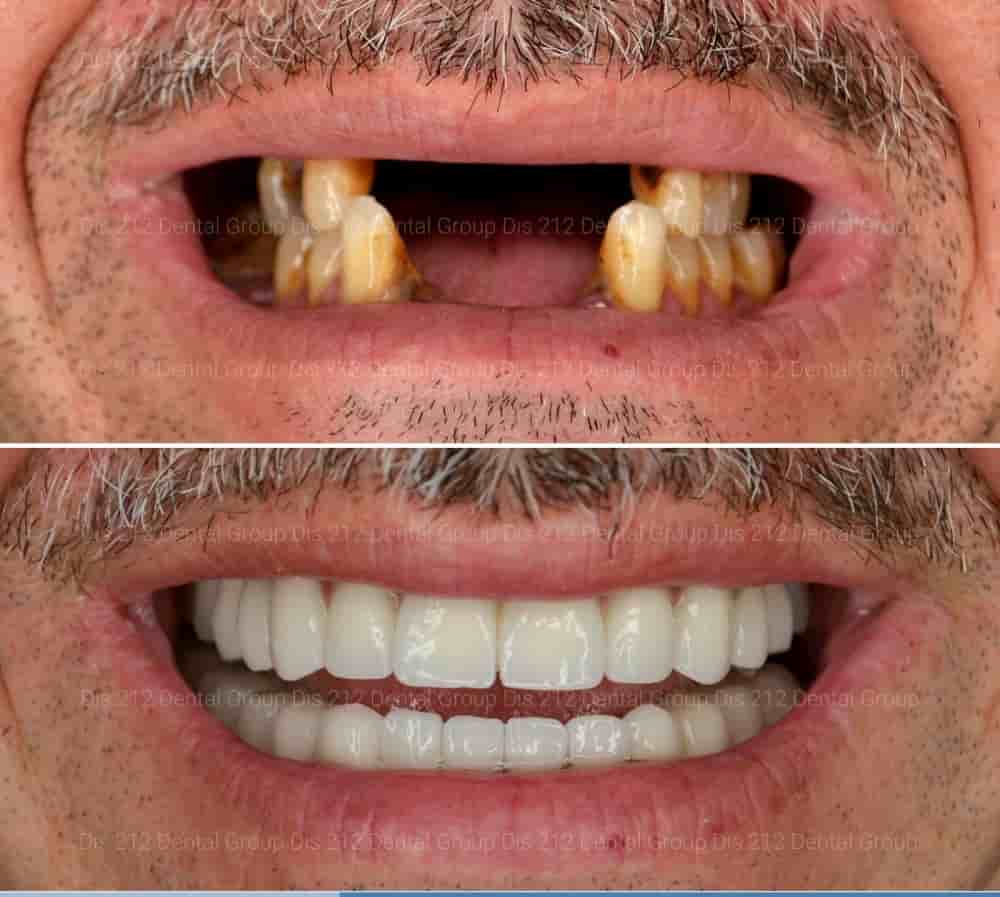 Подтвержденные отзывы пациентов о Dis 212 - Dental Aesthetics Facility в Istanbul, Turkey Slider image 7