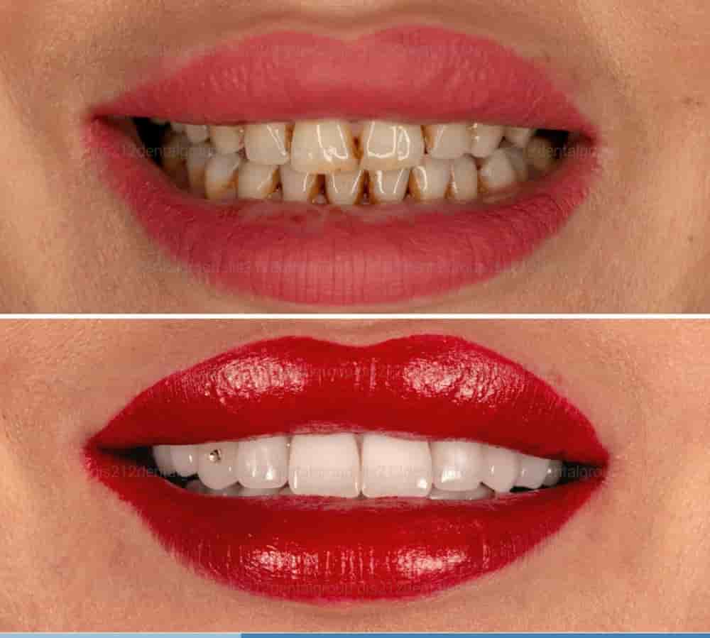 Подтвержденные отзывы пациентов о Dis 212 - Dental Aesthetics Facility в Istanbul, Turkey Slider image 9