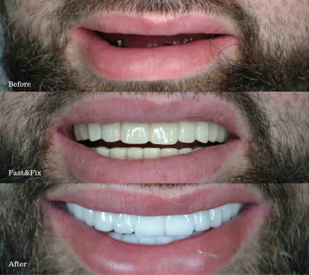 Подтвержденные отзывы пациентов о Dis 212 - Dental Aesthetics Facility в Istanbul, Turkey Slider image 10