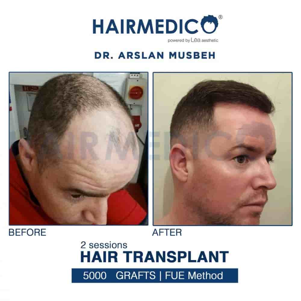 Подтвержденные отзывы пациентов о Hairmedico в Istanbul, Turkey Slider image 3