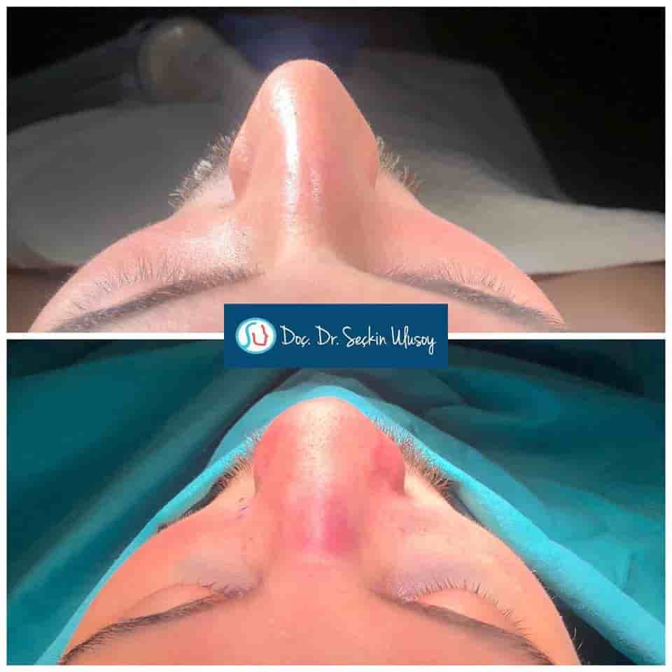 Подтвержденные отзывы пациентов о Istanbulesthe Clinic в Istanbul, Turkey Slider image 1