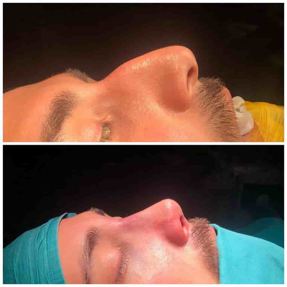 Подтвержденные отзывы пациентов о Istanbulesthe Clinic в Istanbul, Turkey Slider image 2