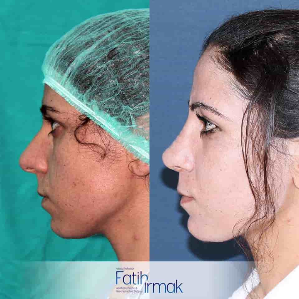 Подтвержденные отзывы пациентов о Assoc. Prof. Fatih Irmak Aesthetic and Plastic Surgery Clinic в Istanbul, Turkey Slider image 1