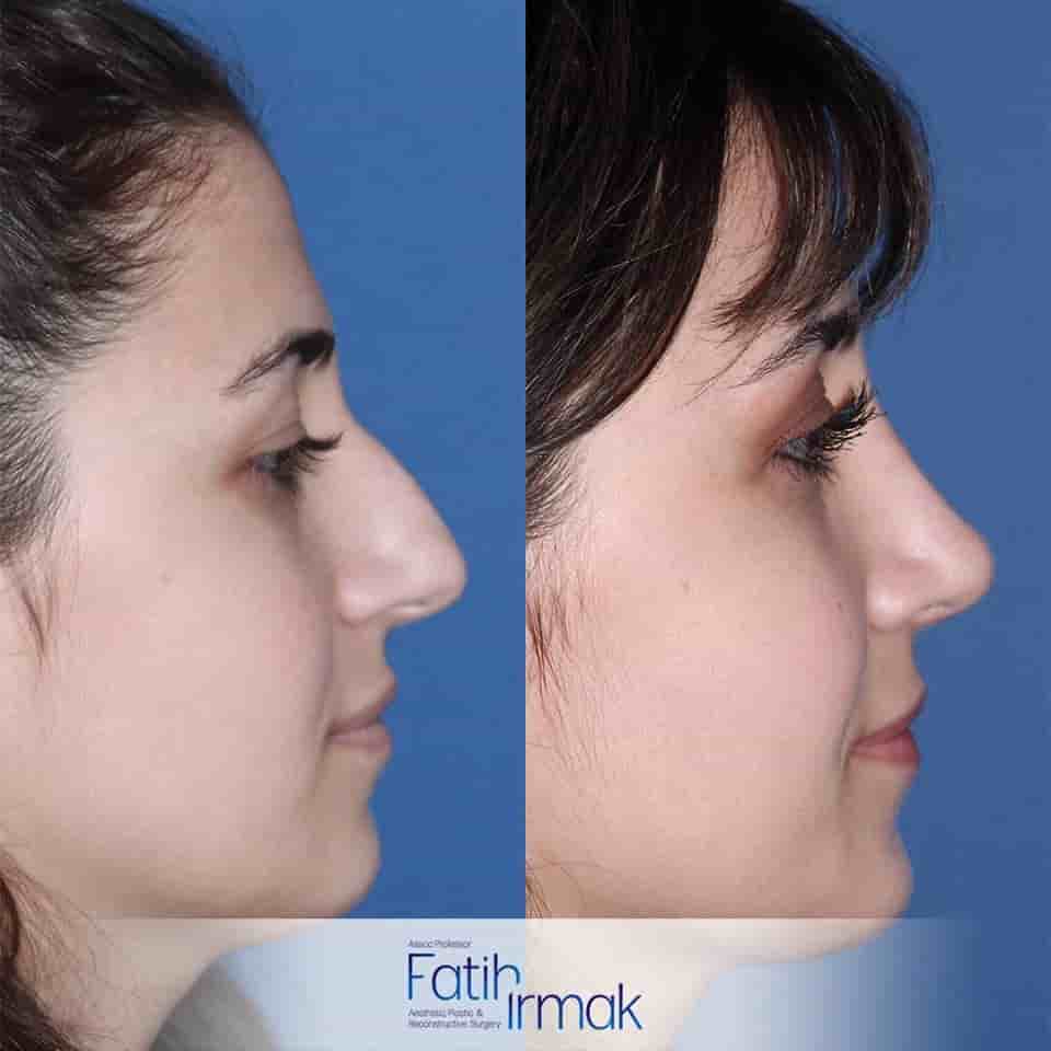 Подтвержденные отзывы пациентов о Assoc. Prof. Fatih Irmak Aesthetic and Plastic Surgery Clinic в Istanbul, Turkey Slider image 3