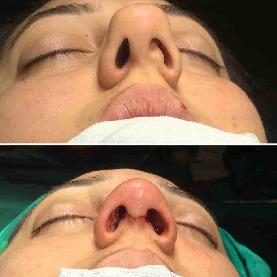 Подтвержденные отзывы пациентов о Estetik Center Clinic by Dr. Ali Dursun Kan MD в Istanbul, Turkey Slider image 3
