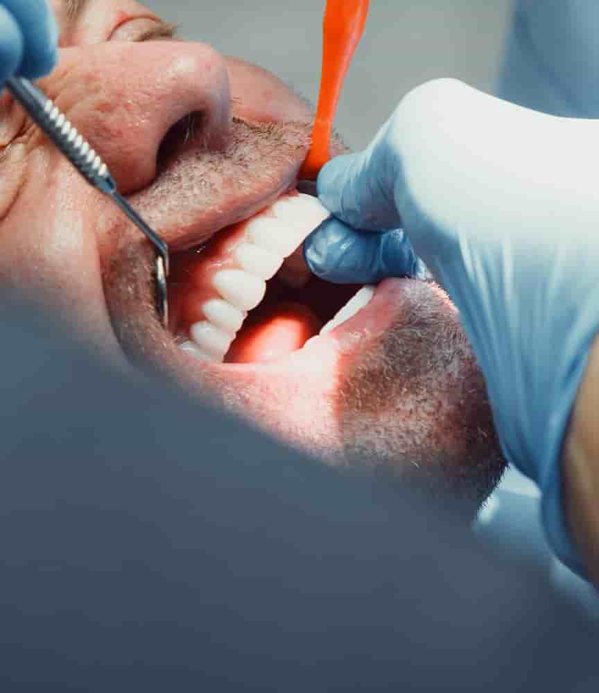 Подтвержденные отзывы пациентов о Beyaz Ada Dental Clinic в Antalya, Turkey Slider image 9