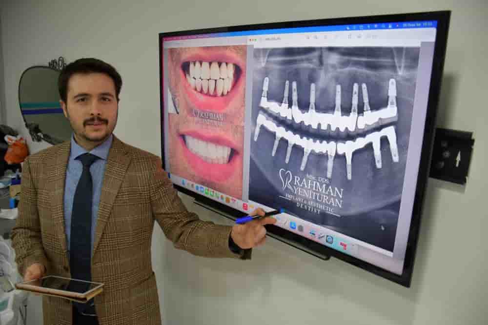 Подтвержденные отзывы пациентов о YKN DENTAL CLINIC в Istanbul, Turkey Slider image 5