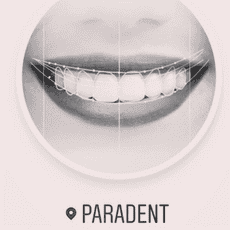 Klinika Dentale ParaDent Reviews in Prishtine, Kosovo Slider image 6