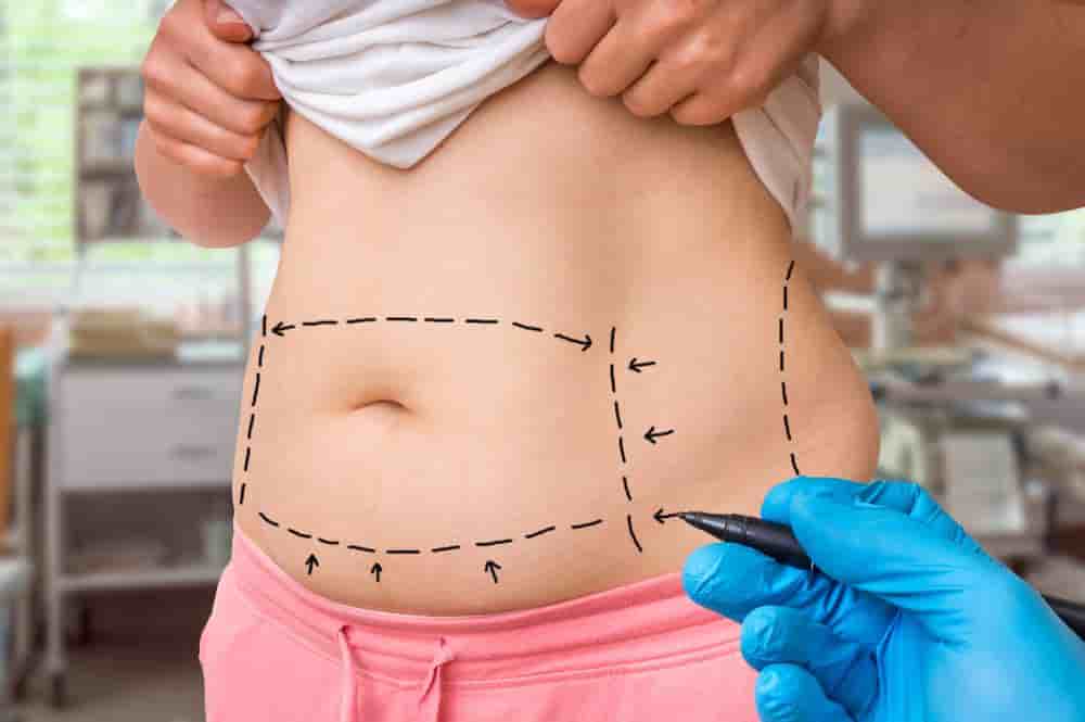 Подтвержденные отзывы пациентов о Dr. Asim Uslu - Reconstructive & Aesthetic Surgeon в Antalya, Turkey Slider image 3
