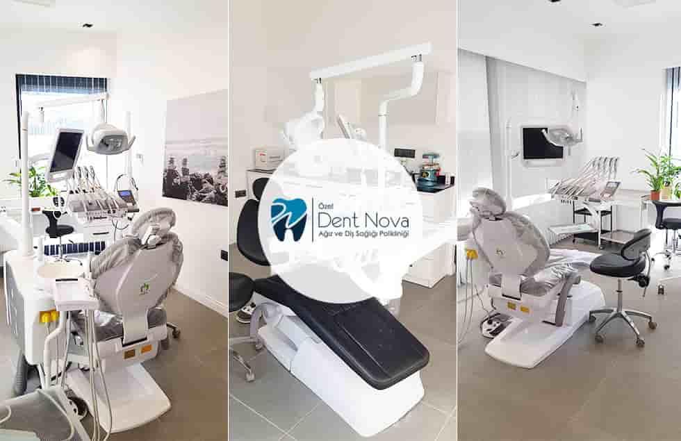 Подтвержденные отзывы пациентов о Dent Nova Dental Clinic в Izmir, Turkey Slider image 3