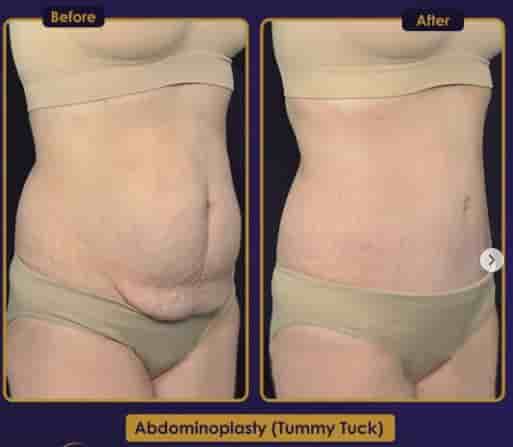 Подтвержденные отзывы пациентов о Estherian Clinic в Istanbul, Turkey Slider image 5