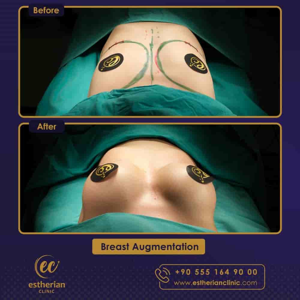 Подтвержденные отзывы пациентов о Estherian Clinic в Istanbul, Turkey Slider image 9