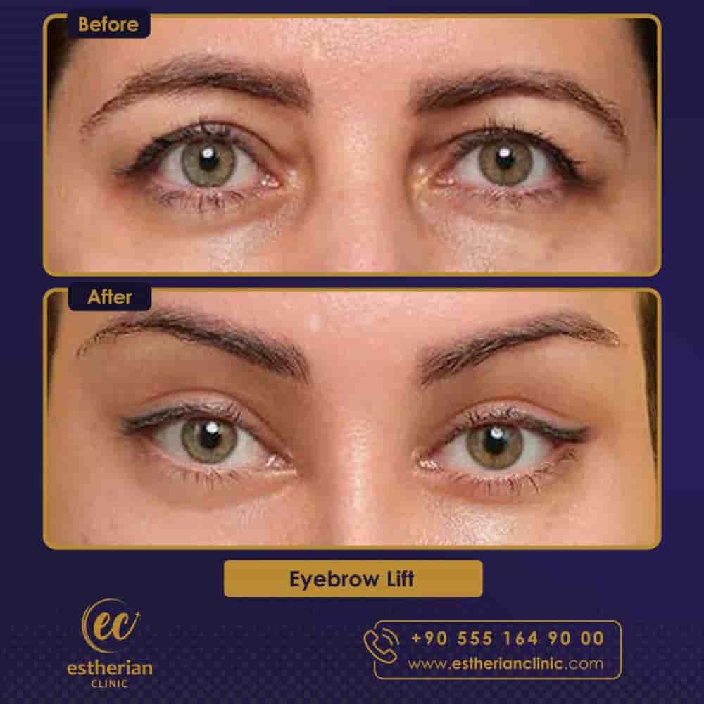 Подтвержденные отзывы пациентов о Estherian Clinic в Istanbul, Turkey Slider image 10