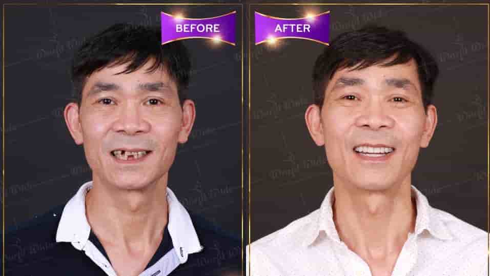 Подтвержденные отзывы пациентов о Worldwide Dental & Cosmetic Surgery Hospital в Ho Chi Minh, Vietnam Slider image 2