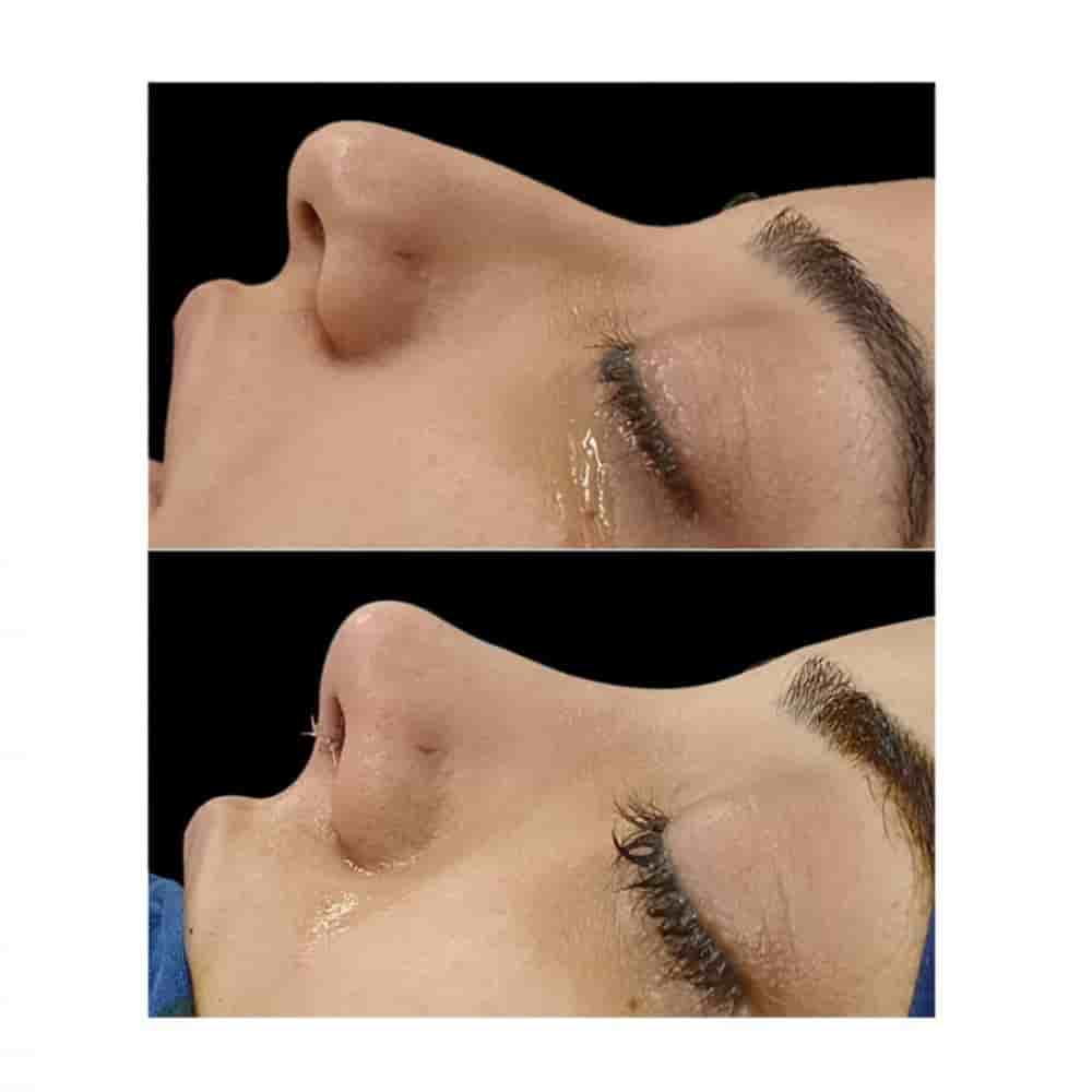 Подтвержденные отзывы пациентов о The Nose Aesthetic Clinic в Istanbul, Turkey Slider image 2