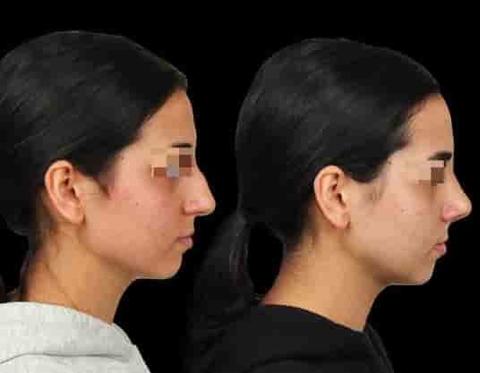 Подтвержденные отзывы пациентов о The Nose Aesthetic Clinic в Istanbul, Turkey Slider image 4