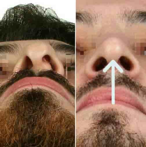 Подтвержденные отзывы пациентов о The Nose Aesthetic Clinic в Istanbul, Turkey Slider image 5