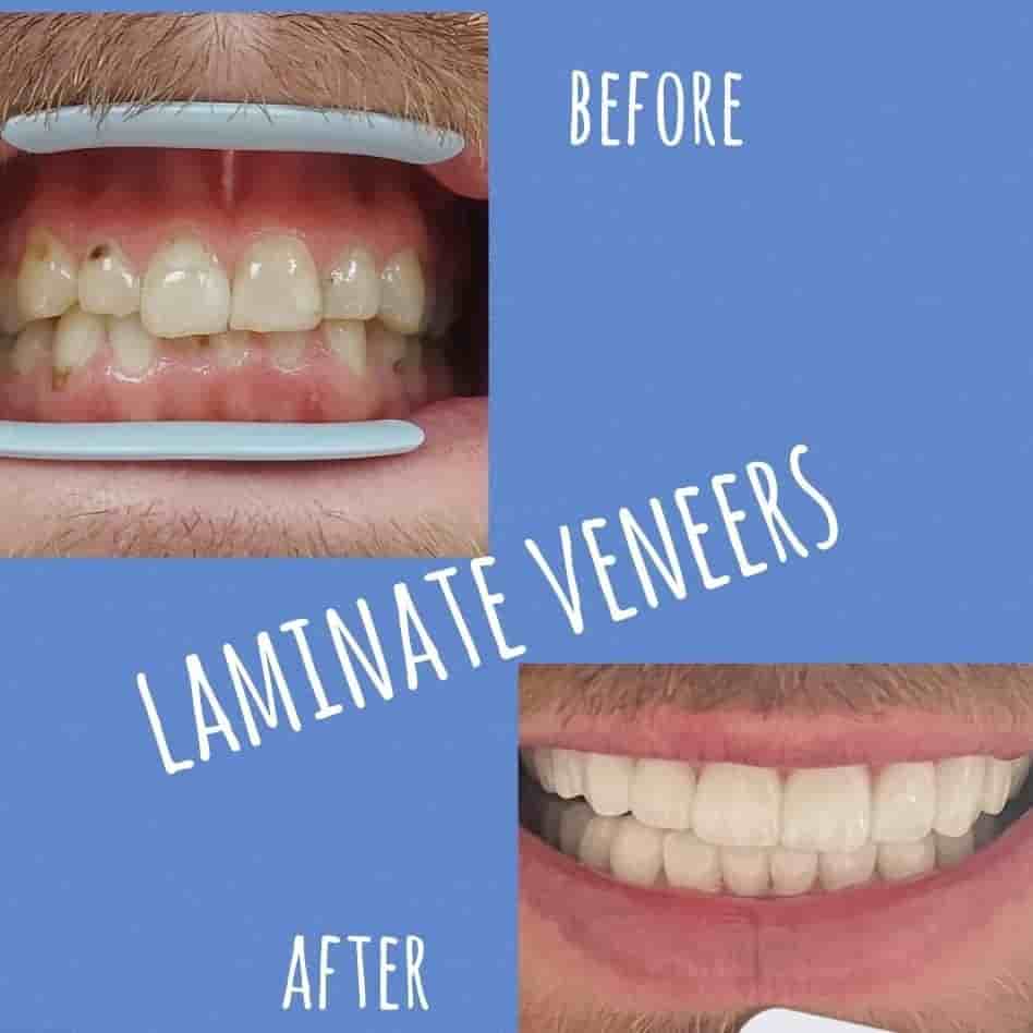 Подтвержденные отзывы пациентов о Park Dental Clinic в Aydin, Turkey Slider image 4