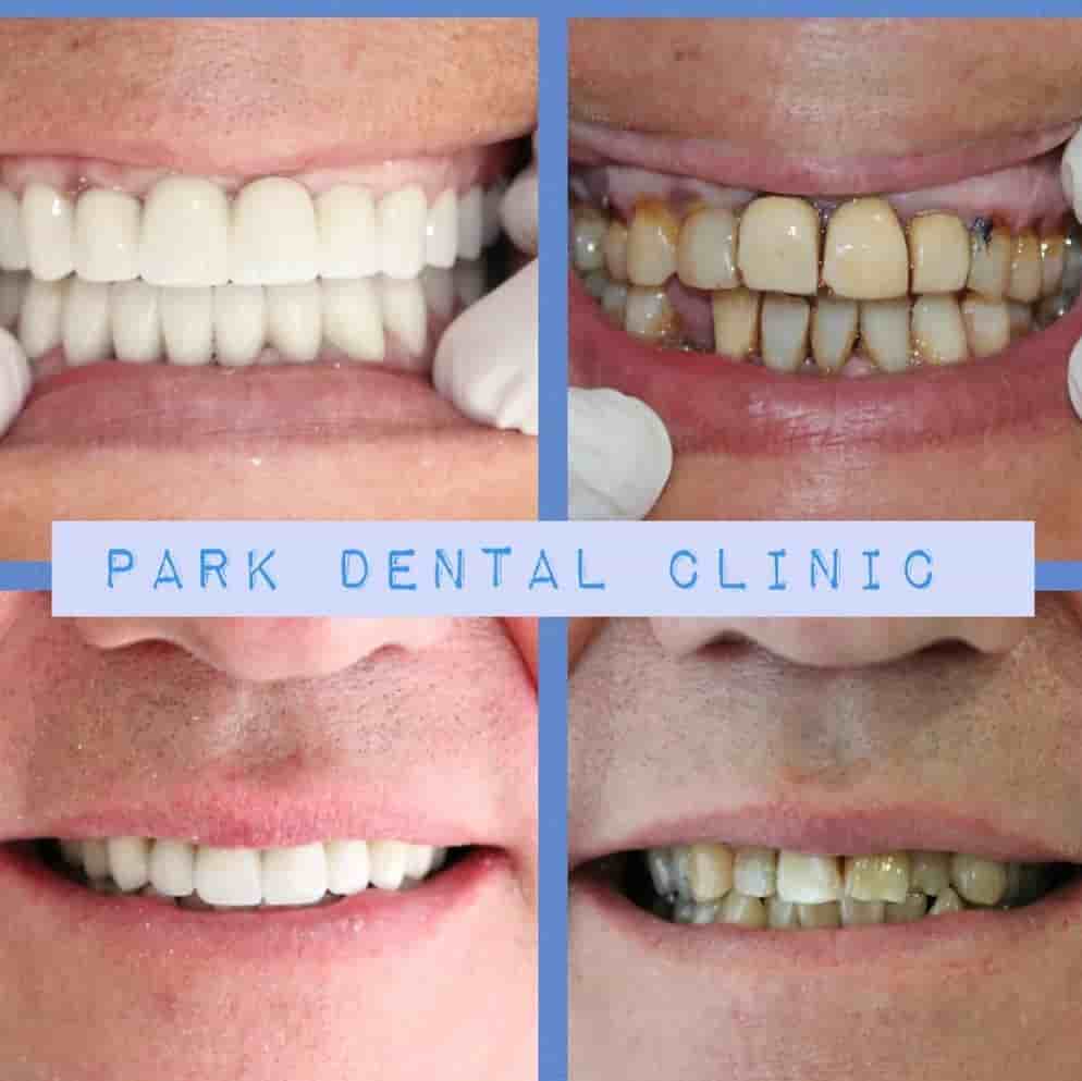 Подтвержденные отзывы пациентов о Park Dental Clinic в Aydin, Turkey Slider image 6