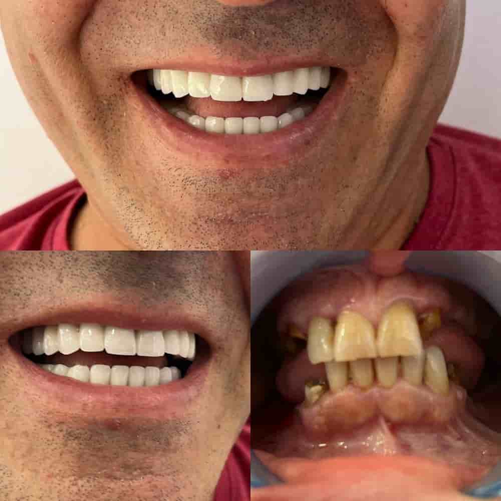 Подтвержденные отзывы пациентов о Zirve Dental в Aydin, Turkey Slider image 9