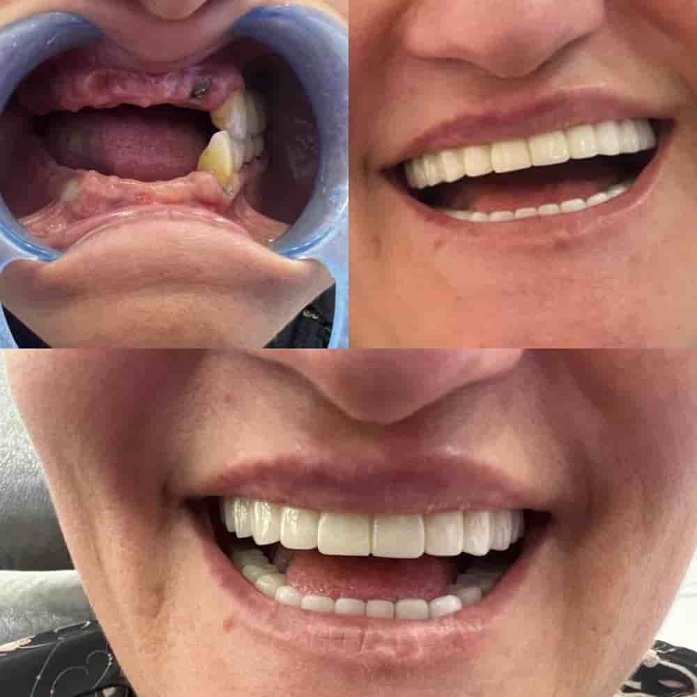 Подтвержденные отзывы пациентов о Zirve Dental в Aydin, Turkey Slider image 1
