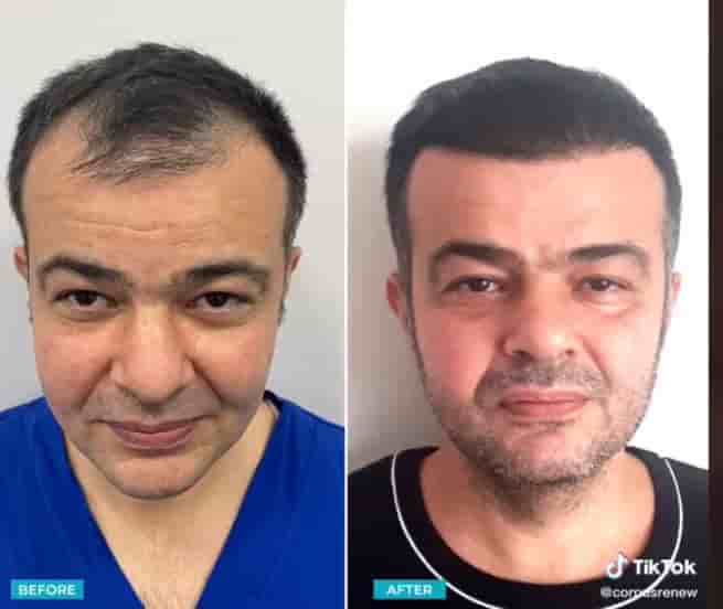 Подтвержденные отзывы пациентов о CorpusRenew by Termessos Hospital в Antalya, Turkey Slider image 3
