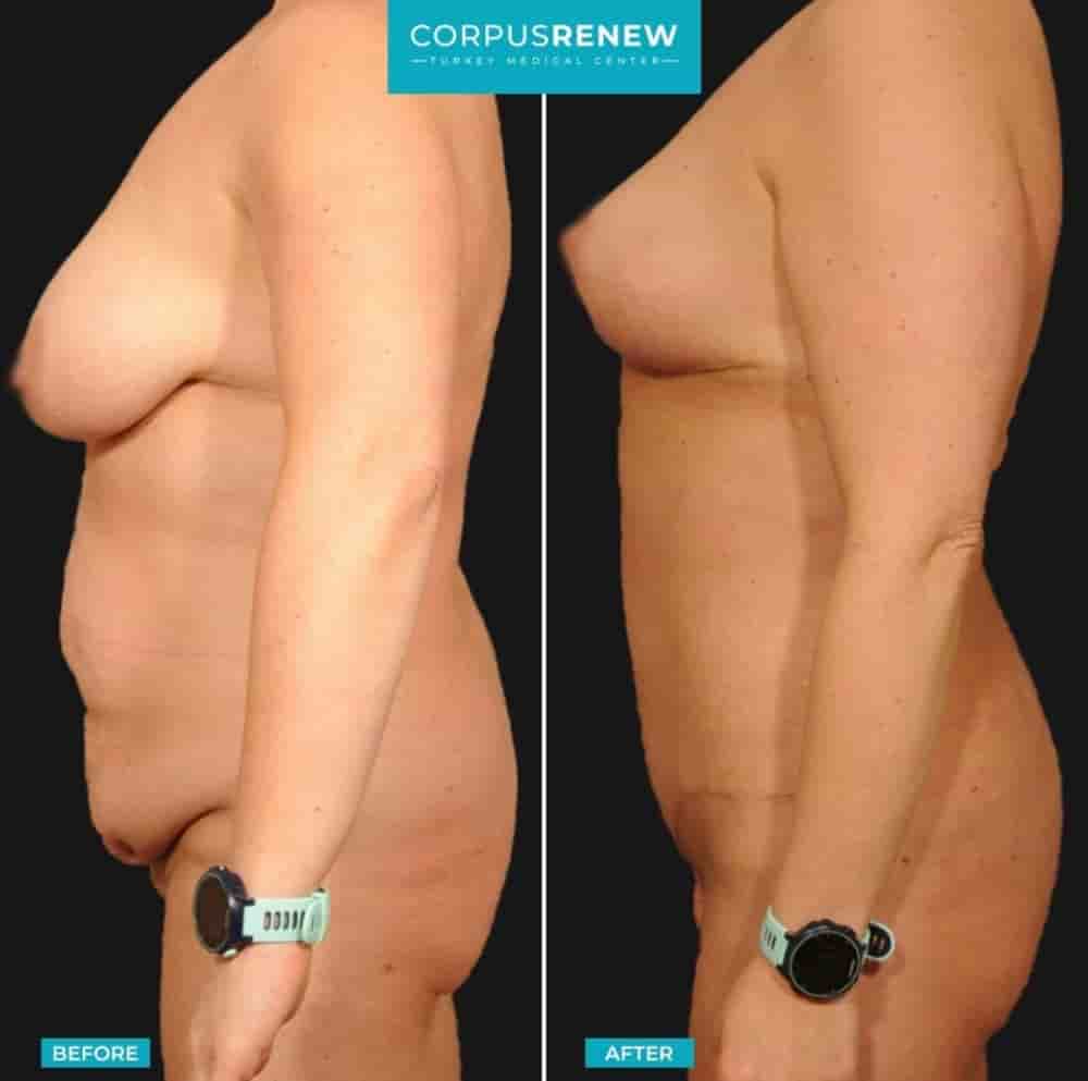 Подтвержденные отзывы пациентов о CorpusRenew by Termessos Hospital в Antalya, Turkey Slider image 1