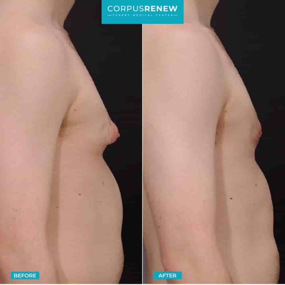 Подтвержденные отзывы пациентов о CorpusRenew by Termessos Hospital в Antalya, Turkey Slider image 8