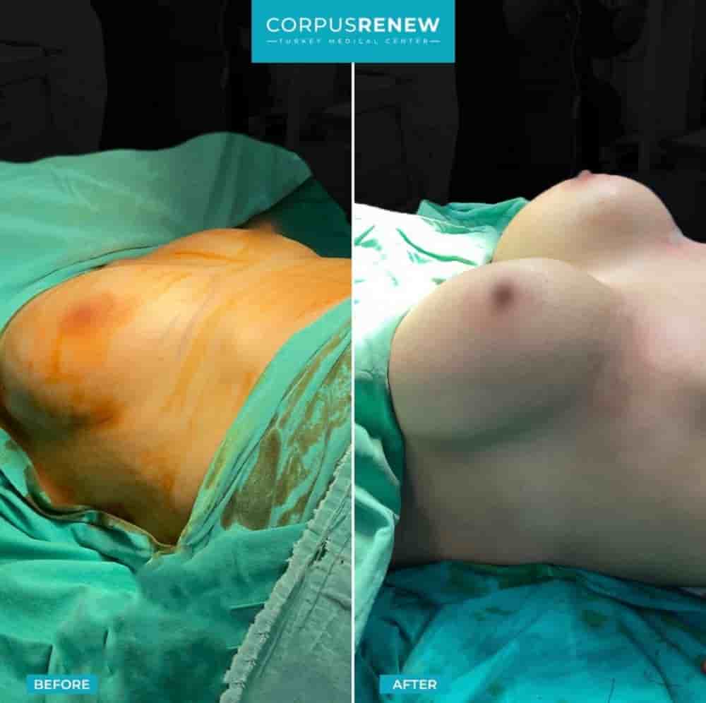 Подтвержденные отзывы пациентов о CorpusRenew by Termessos Hospital в Antalya, Turkey Slider image 9
