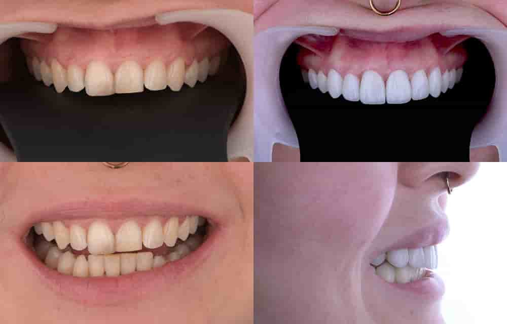 Подтвержденные отзывы пациентов о Dentleon Polyclinics в Izmir, Turkey Slider image 4