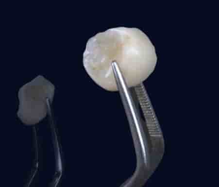 Подтвержденные отзывы пациентов о Smile Zone Clinic в Ankara, Turkey Slider image 2