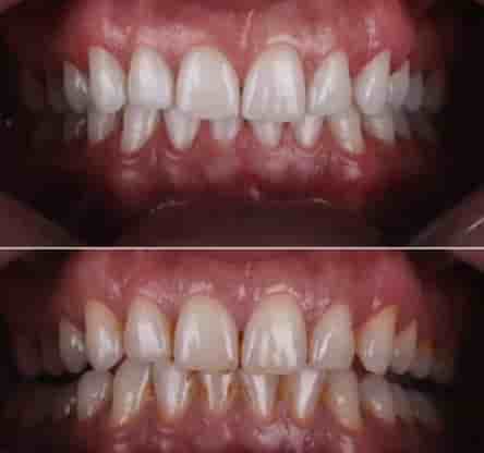 Подтвержденные отзывы пациентов о Smile Zone Clinic в Ankara, Turkey Slider image 4