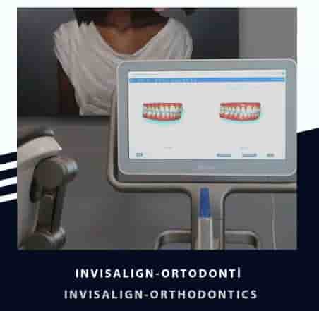 Подтвержденные отзывы пациентов о Smile Zone Clinic в Ankara, Turkey Slider image 5
