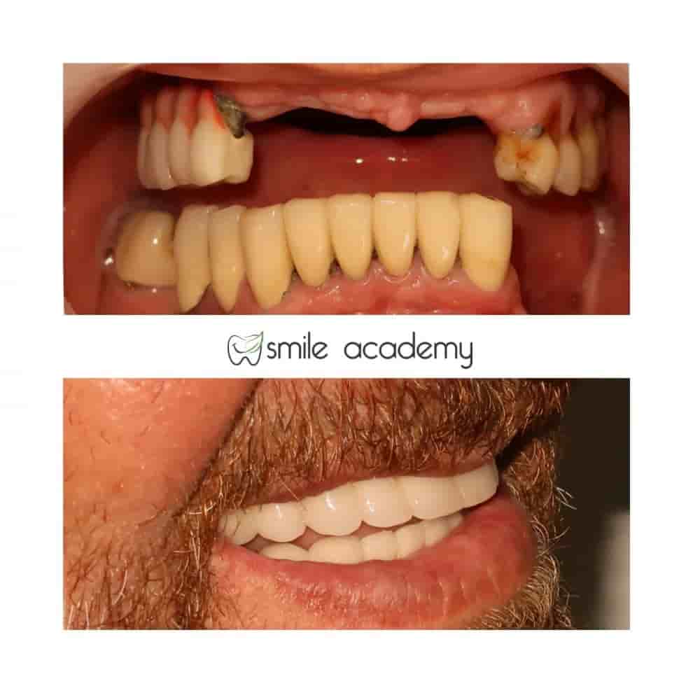 Подтвержденные отзывы пациентов о Esthetic Smile Academy  в Istanbul, Turkey Slider image 2