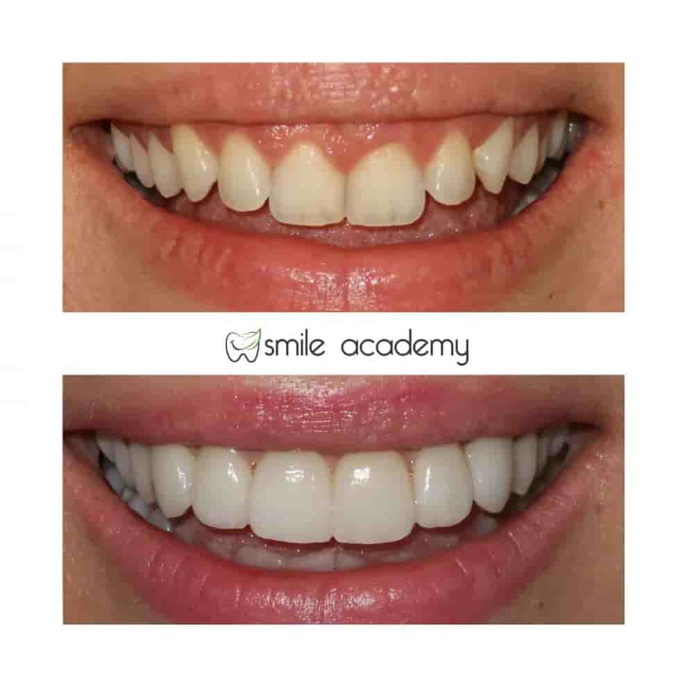 Подтвержденные отзывы пациентов о Esthetic Smile Academy  в Istanbul, Turkey Slider image 4