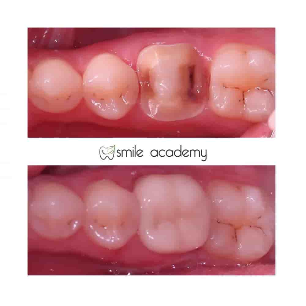 Подтвержденные отзывы пациентов о Esthetic Smile Academy  в Istanbul, Turkey Slider image 7