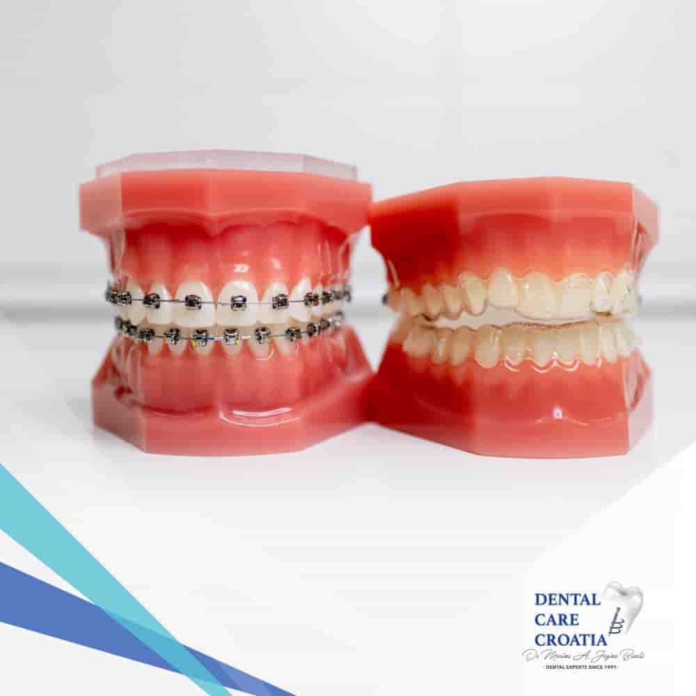 Подтвержденные отзывы пациентов о Dental Care Croatia в Split, Croatia Slider image 3