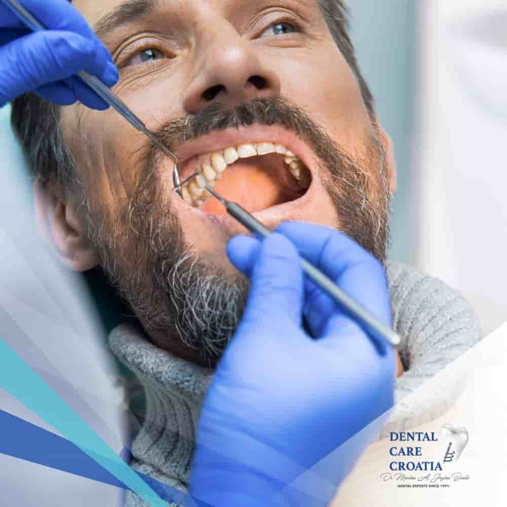 Подтвержденные отзывы пациентов о Dental Care Croatia в Split, Croatia Slider image 7