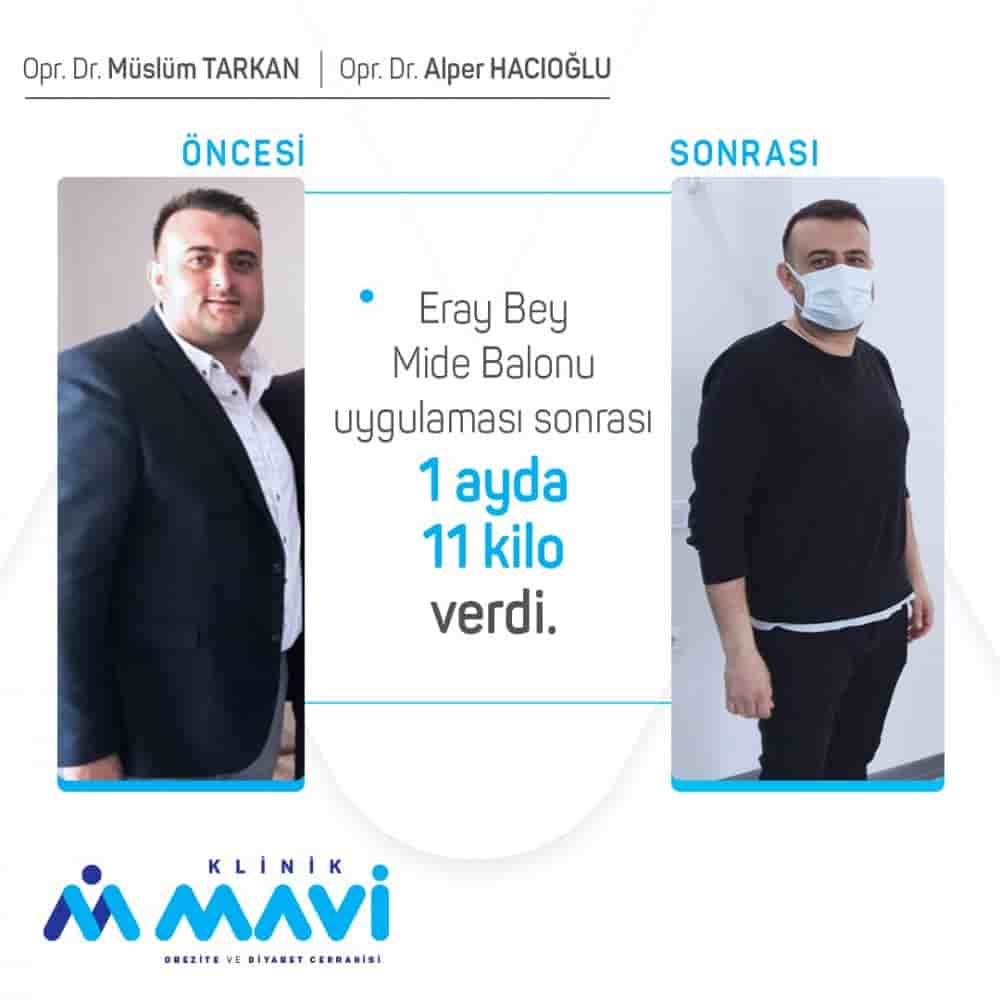 Подтвержденные отзывы пациентов о Klinik Mavi в Eskisehir, Turkey Slider image 1