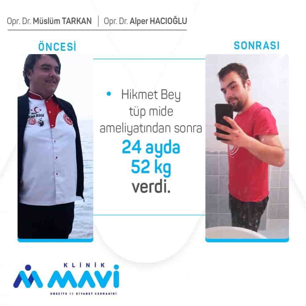 Подтвержденные отзывы пациентов о Klinik Mavi в Eskisehir, Turkey Slider image 2