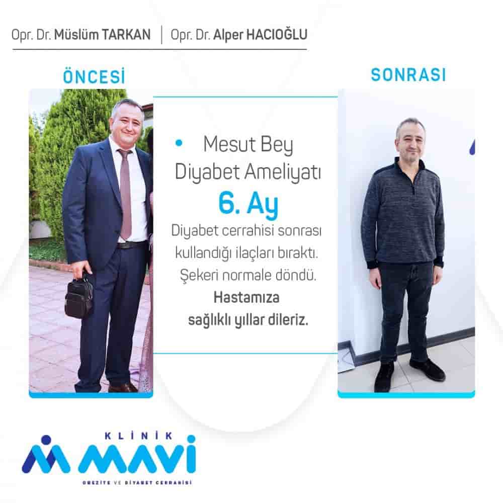 Подтвержденные отзывы пациентов о Klinik Mavi в Eskisehir, Turkey Slider image 4