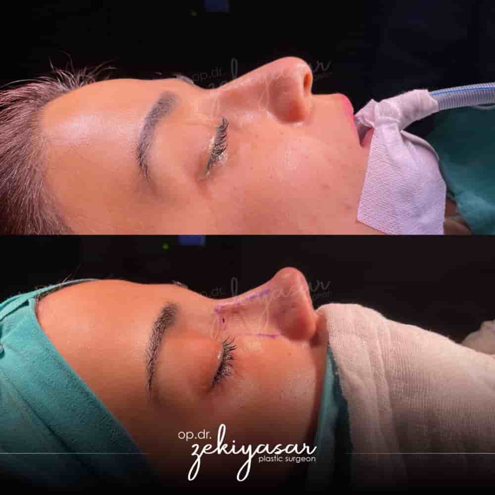 Подтвержденные отзывы пациентов о Dr. Zeki Yasar Clinic в Istanbul, Turkey Slider image 4