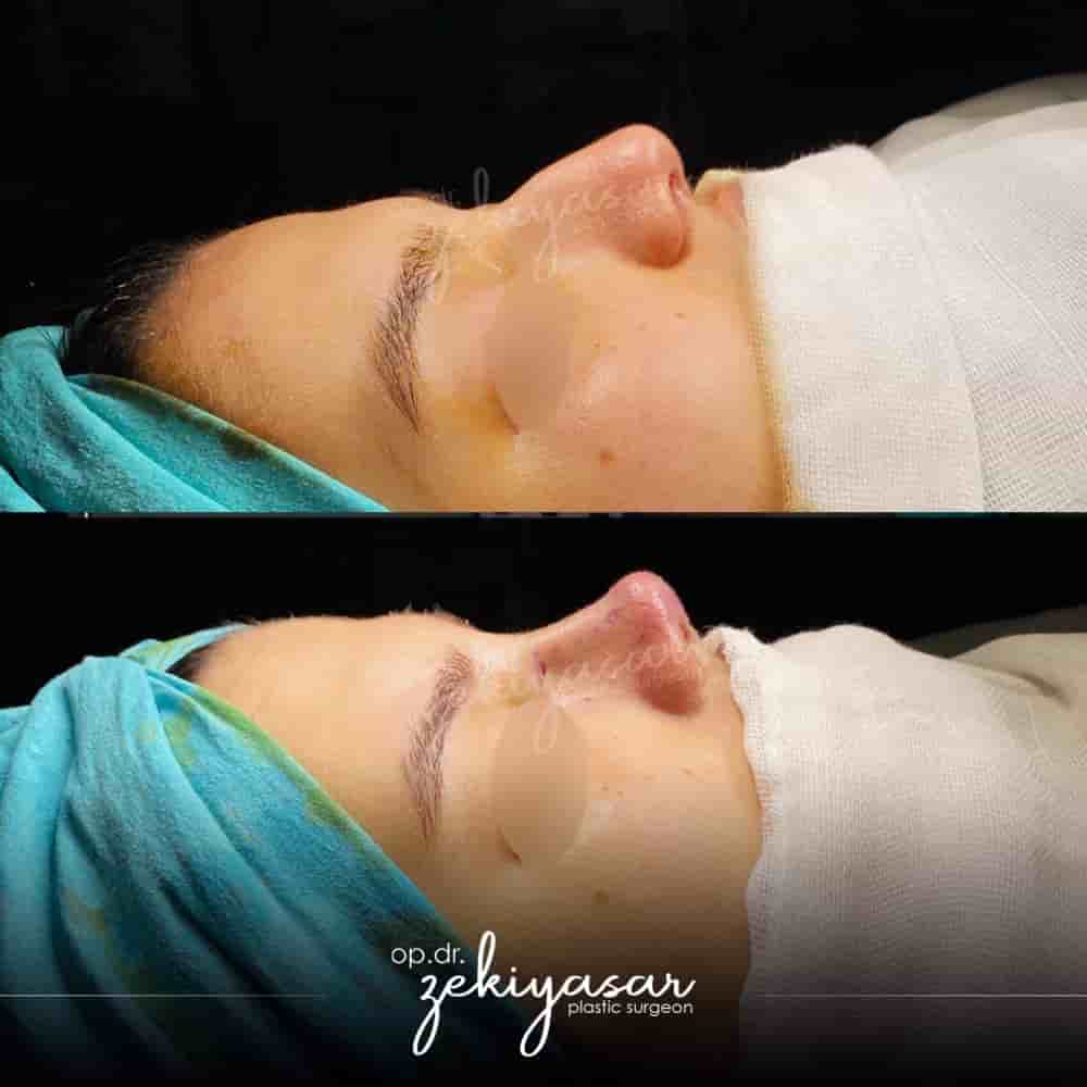 Подтвержденные отзывы пациентов о Dr. Zeki Yasar Clinic в Istanbul, Turkey Slider image 6