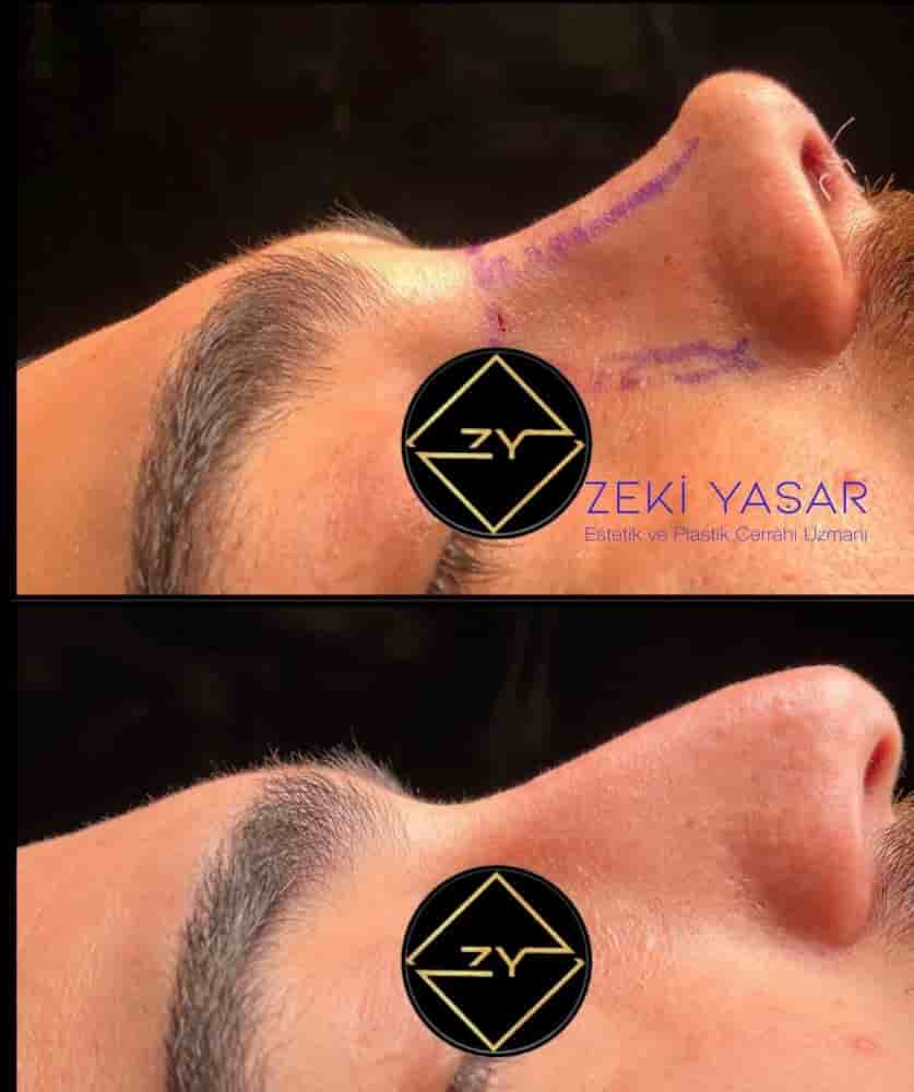 Подтвержденные отзывы пациентов о Dr. Zeki Yasar Clinic в Istanbul, Turkey Slider image 7