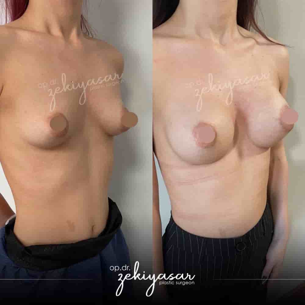 Подтвержденные отзывы пациентов о Dr. Zeki Yasar Clinic в Istanbul, Turkey Slider image 9