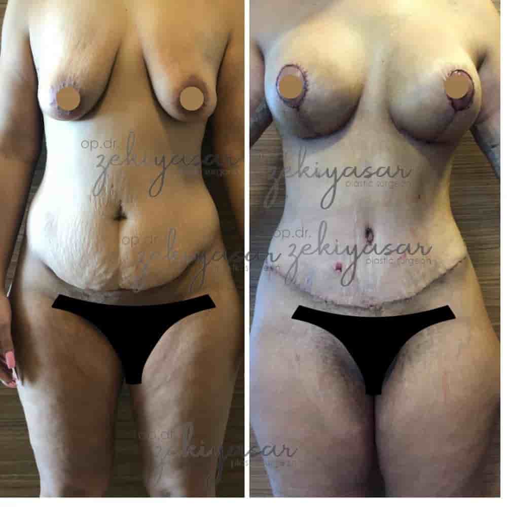 Подтвержденные отзывы пациентов о Dr. Zeki Yasar Clinic в Istanbul, Turkey Slider image 10